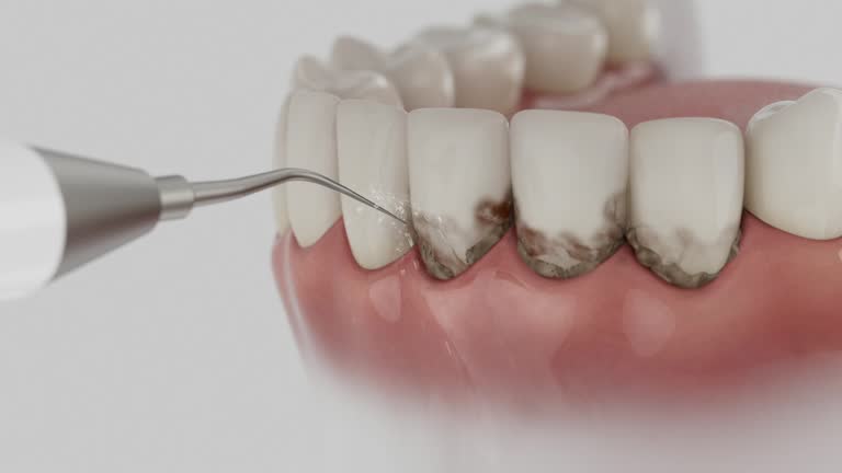 Trusted Teeth Whitening service in Long Beach, IN - Dentist Open Now